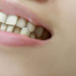 日本人の８割は要歯科矯正　口臭も？　医療費も減らせるオーラルケア！