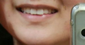 431a1398e29551c25218938e265e8ab5 300x159 - ニオイ、歯並び、色の悪さを指摘される日本人　遅れたオーラルケア